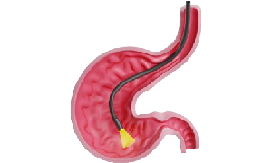 Best Gastroenterologist in Kerala
