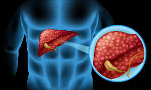 Best Gastroenterologist in Kerala