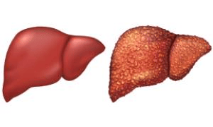 Gastroenterologist in Kerala