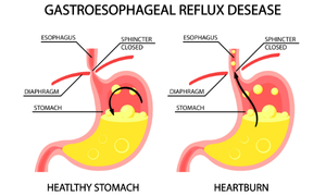 Gastroenterologist near me